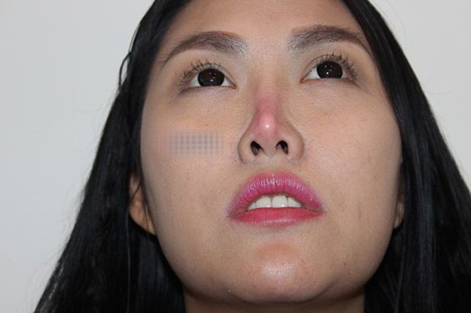 Sao Vbiz và những lần khiến dân mạng tá hoả vì gương mặt biến chứng do phẫu thuật thẩm mỹ - Ảnh 6.
