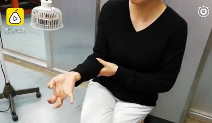 Trung Quốc: Nữ game thủ bị liệt ngón tay vì chơi game trên smartphone suốt 1 tuần không nghỉ - Ảnh 1. Trung Quốc: Nữ game thủ bị liệt ngón tay vì chơi game trên smartphone suốt 1 tuần không nghỉ - Ảnh 1.