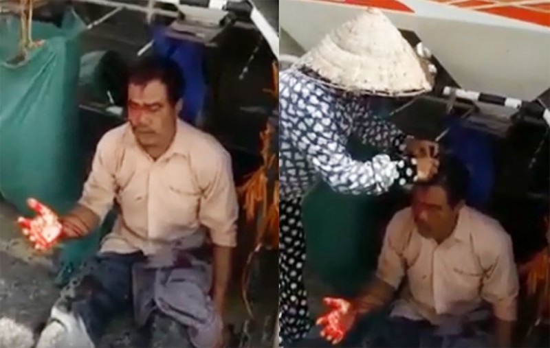 Người đàn ông gặt lúa thuê bị đánh rách toác da đầu - Ảnh 1. Người đàn ông gặt lúa thuê bị đánh rách toác da đầu - Ảnh 1.