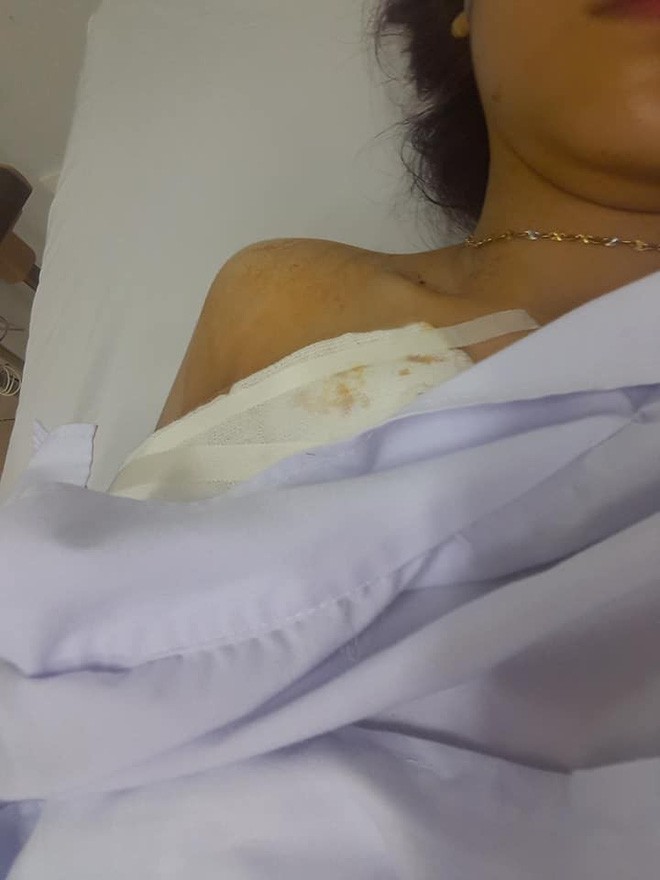 Xôn xao vụ cô gái xinh xắn bị cướp đâm trọng thương trước ngày đăng kí kết hôn - Ảnh 2.