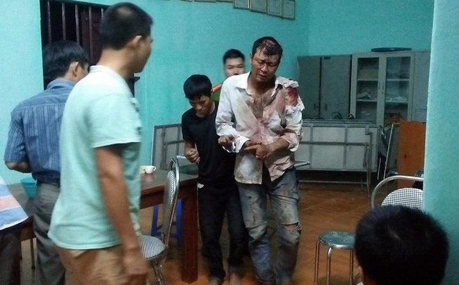 Hai thanh niên Hà Nội lên Hòa Bình trộm dê bị người dân đánh nhập viện - Ảnh 1.