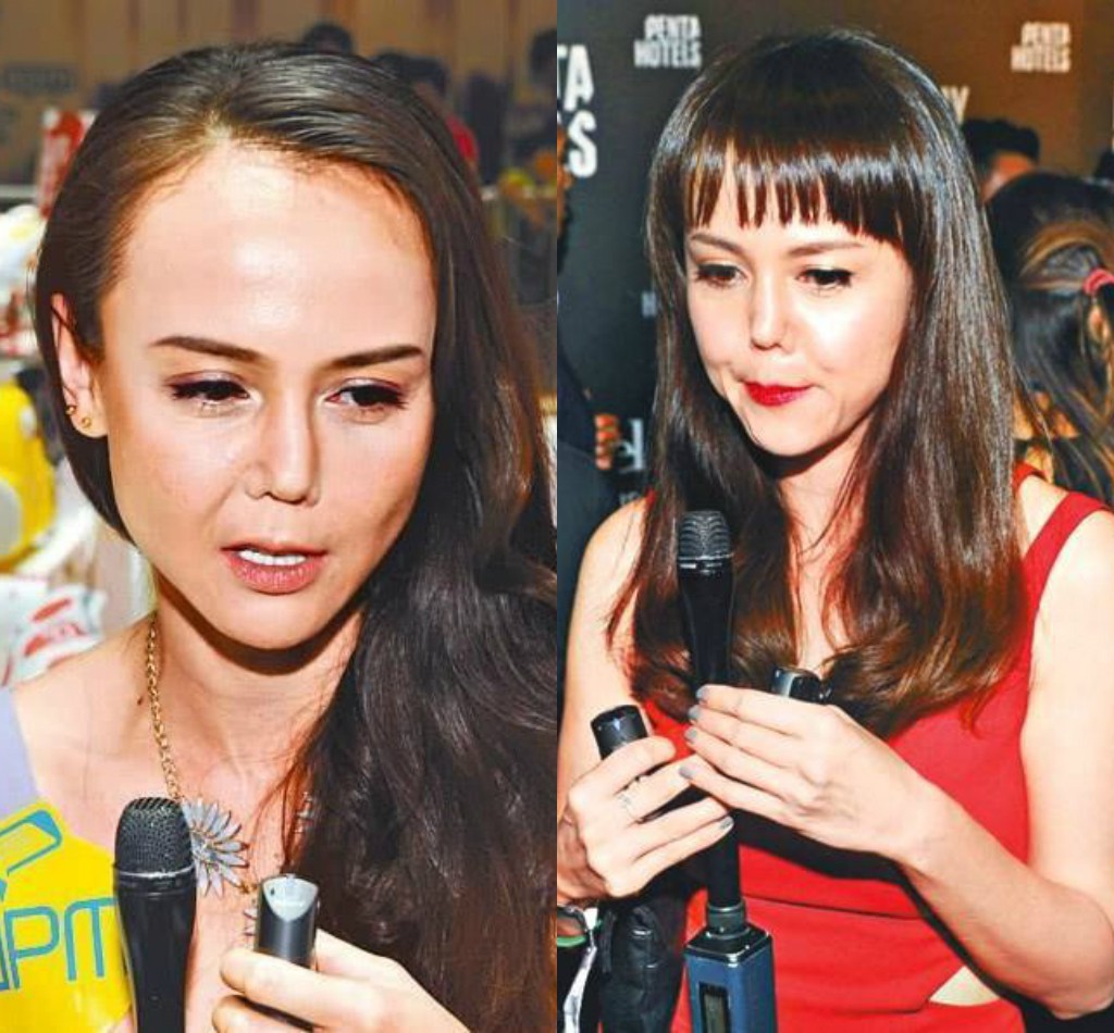 Lãnh hậu quả từ phẫu thuật thẩm mỹ nhưng những sao nữ châu Á này đã được bù đắp bằng tình yêu hoàn mỹ - Ảnh 15. Lãnh hậu quả từ phẫu thuật thẩm mỹ nhưng những sao nữ châu Á này đã được bù đắp bằng tình yêu hoàn mỹ - Ảnh 15.