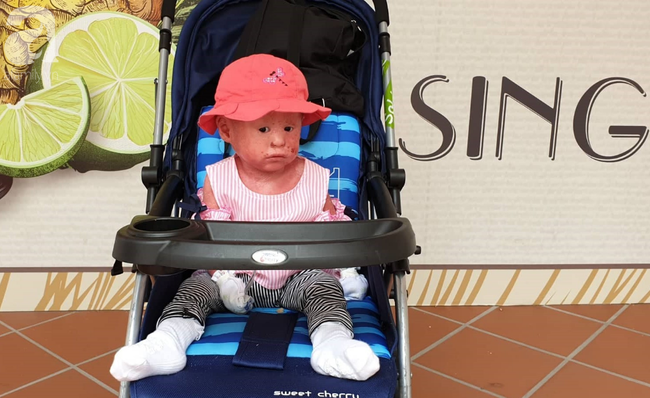 Hình ảnh mới nhất của bé Bích bị bỏ rơi, người đầy vẩy ngứa như da trăn sau đợt khám bệnh đầu tiên tại Singapore - Ảnh 9. Hình ảnh mới nhất của bé Bích bị bỏ rơi, người đầy vẩy ngứa như da trăn sau đợt khám bệnh đầu tiên tại Singapore - Ảnh 9.