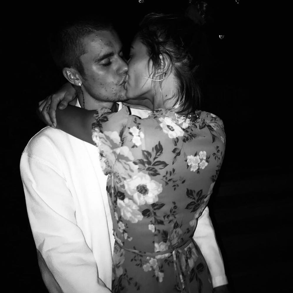 Justin Bieber khoe áº£nh khÃ³a mÃ´i vá»i Hailey, nhÆ°ng gÃ¢y chÃº Ã½ hÆ¡n lÃ  lÃ n da chi chÃ­t má»¥n cá»§a anh chÃ ng - áº¢nh 1.