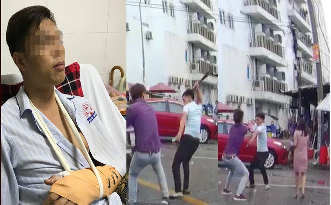 Vụ chặt tay tài xế ô tô: Nạn nhân bị đứt động mạch, máu phun không ngừng khi vào bệnh viện - Ảnh 1.