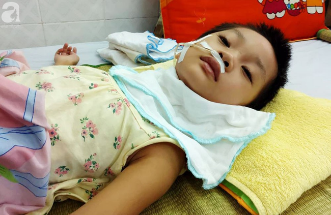 Bé gái 5 tuổi bị viêm màng não tự miễn sau cơn co giật, hơn 1 tháng không thể ngủ và liên tục la hét - Ảnh 2.
