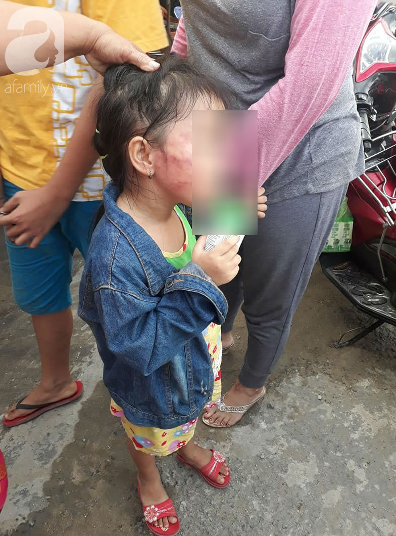 Bố của bé gái 5 tuổi bị bảo mẫu tát liên tiếp vào mặt, dọa lấy kéo cắt lưỡi: Cô ấy cũng đáng thương - Ảnh 1. Bố của bé gái 5 tuổi bị bảo mẫu tát liên tiếp vào mặt, dọa lấy kéo cắt lưỡi: Cô ấy cũng đáng thương - Ảnh 1.