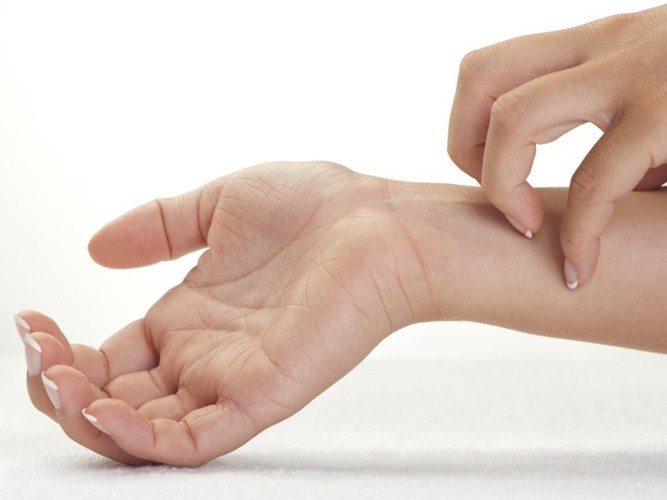 Da bị ngứa, mẩn đỏ cảnh báo vấn đề gì về sức khỏe? - Ảnh 9. Da bị ngứa, mẩn đỏ cảnh báo vấn đề gì về sức khỏe? - Ảnh 9.