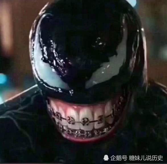 Quá yêu mến gã Venom, netizen Trung sắm ngay tặng chàng một bộ niềng răng - Ảnh 2.