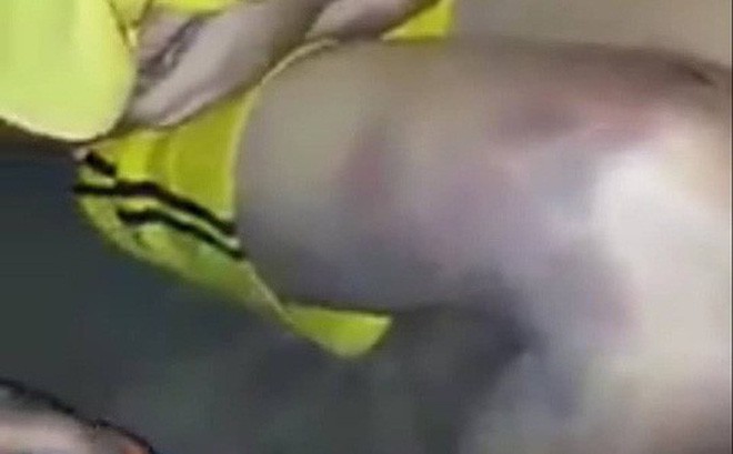 Nam sinh lớp 9 bị cha đ&aacute;nh đập d&atilde; man v&igrave; d&ugrave;ng ma t&uacute;y: C&oacute; hai thanh ni&ecirc;n kề dao v&agrave;o cổ &eacute;p ch&aacute;u chơi, c&ograve;n dọa sẽ giết cả nh&agrave; - Ảnh 3.