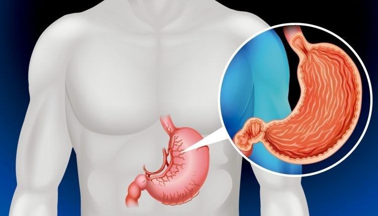 Cô gái 20 tuổi mắc bệnh ung thư dạ dày giai đoạn cuối chỉ vì thói quen mà giới trẻ rất hay mắc phải - Ảnh 2. Cô gái 20 tuổi mắc bệnh ung thư dạ dày giai đoạn cuối chỉ vì thói quen mà giới trẻ rất hay mắc phải - Ảnh 2.