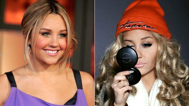 Vượt qua scandal nghiện ngập, nữ hoàng phim teen một thời Amanda Bynes tái xuất xinh đẹp đến bất ngờ - Ảnh 1.