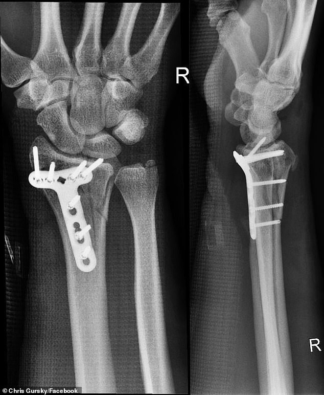 G&oacute;c h&uacute; hồn: Lần đầu chơi d&ugrave; lượn, Youtuber nổi tiếng su&yacute;t mất mạng v&igrave; kh&ocirc;ng được đeo m&oacute;c an to&agrave;n - Ảnh 10.