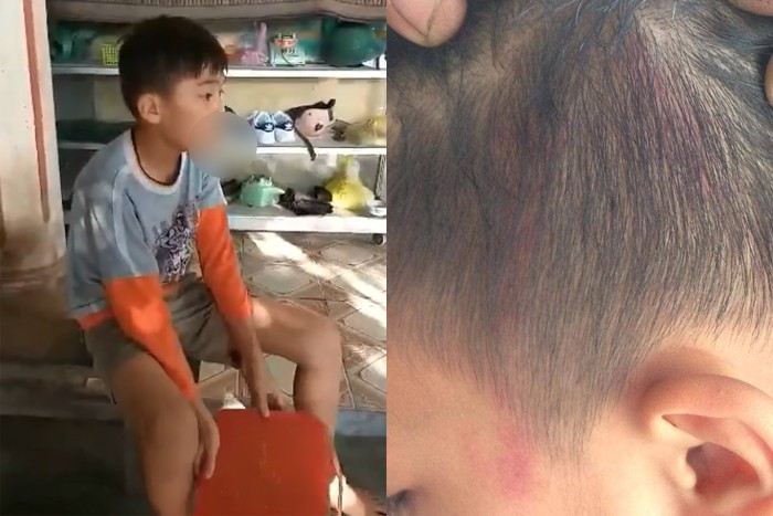 Nam sinh bị ấn đầu vào tường, đập vào giá đỡ bình cứu hỏa: UBND huyện thông tin chính thức - Ảnh 1. Nam sinh bị ấn đầu vào tường, đập vào giá đỡ bình cứu hỏa: UBND huyện thông tin chính thức - Ảnh 1.