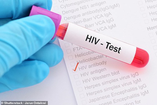 Phát hiện cơ chế giúp chữa khỏi HIV ngay trong não người - Ảnh 1.