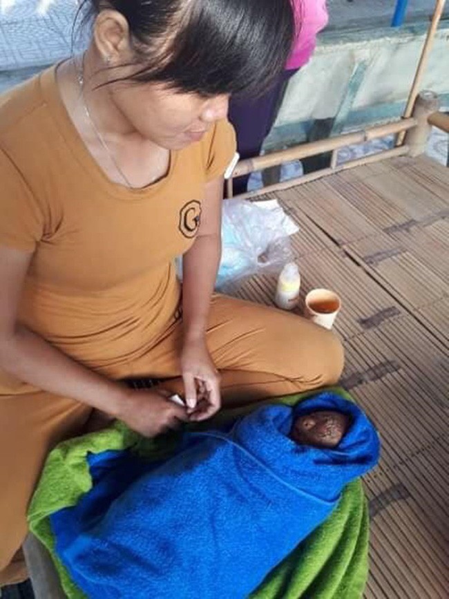 Tây Ninh: Bé trai chưa đầy 1 tháng tuổi, người đầy vảy ngứa như da trăn bị bố mẹ bỏ rơi ngoài đường - Ảnh 2.