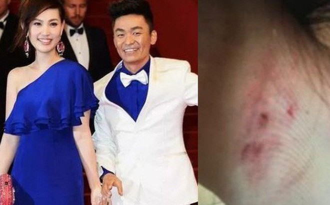 10 ng&ocirc;i sao Cbiz g&acirc;y s&oacute;ng gi&oacute; nhất MXH năm 2018: Người cầm dao đ&acirc;m chồng, kẻ g&acirc;y hoạ chỉ v&igrave; like dạo - Ảnh 20.