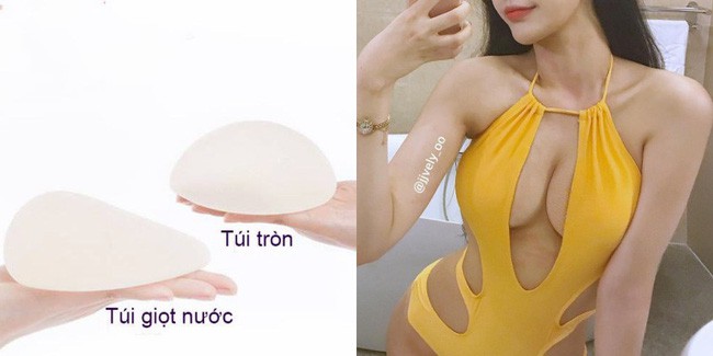 Với nhược điểm ngực lép, phụ nữ Châu Á nên chọn túi ngực dáng tròn hay dáng giọt nước? - Ảnh 3.