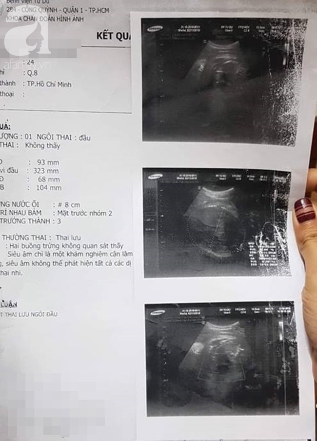 TP.HCM: Thai phụ 24 tuổi tố bác sĩ bệnh viện Từ Dũ tắc trách làm mất con trai đầu lòng - Ảnh 6.