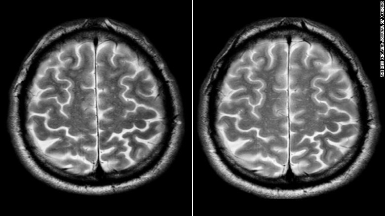 Loạt phản ứng của cơ thể trong m&ocirc;i trường v&ocirc; trọng lực: H&oacute;a ra, việc sống ở sao Hỏa vẫn c&ograve;n xa lắm - Ảnh 1.