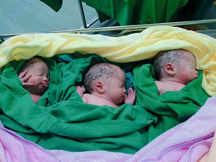 Nghệ An: Siêu âm thai đôi, sản phụ “vượt cạn” sinh 3 bé gái - Ảnh 1. Nghệ An: Siêu âm thai đôi, sản phụ “vượt cạn” sinh 3 bé gái - Ảnh 1.