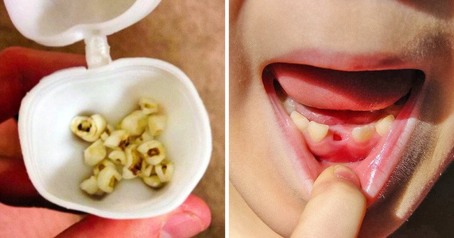 Đánh răng 2 lần/ngày thôi chưa đủ, nha sĩ nào cũng muốn bạn biết những điều này để bảo vệ răng miệng - Ảnh 1.