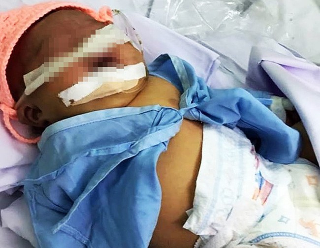 Bé gái nặng 4kg nhưng cho sinh thường ở Bình Thuận bị tổn thương thần kinh cánh tay và hôn mê - Ảnh 2. Bé gái nặng 4kg nhưng cho sinh thường ở Bình Thuận bị tổn thương thần kinh cánh tay và hôn mê - Ảnh 2.