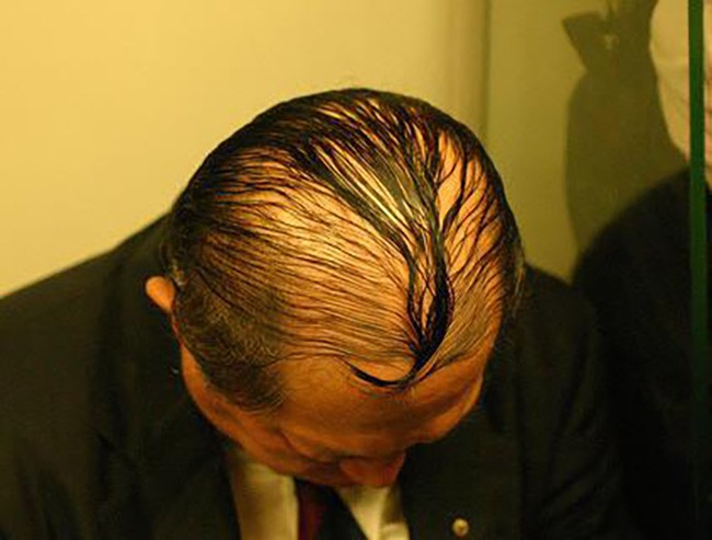 Tuyển tập 14 mẫu tóc che mưa dành cho các quý ông đầu hói - Ảnh 23.