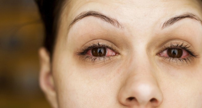 Đừng chủ quan bỏ qua nếu thấy mắt xuất hiện các triệu chứng bất thường sau - Ảnh 3.