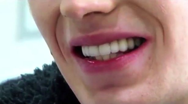 Ai cũng ph&aacute;t ngất trước b&iacute; mật dễ sợ của ch&agrave;ng thanh ni&ecirc;n kh&ocirc;ng bao giờ cười: 20 năm chưa từng đ&aacute;nh răng - Ảnh 6.