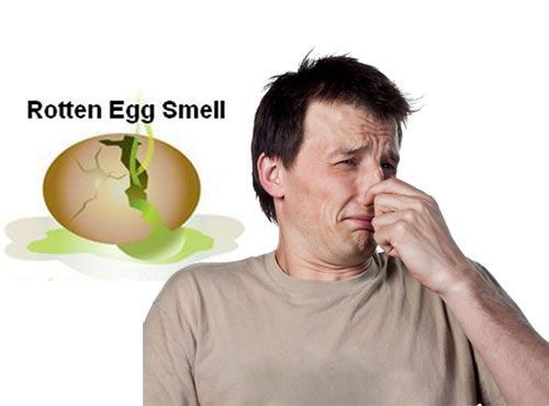 Mùi hôi cơ thể bạn tiết lộ điều gì về sức khỏe của bạn? - Ảnh 7.