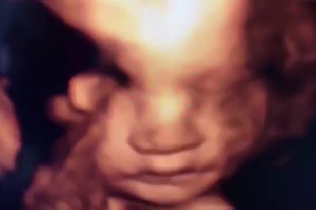 Xem tấm hình chụp thai nhi 30 tuần tuổi, người mẹ bất ngờ khi thấy hành động của đứa con trong bụng - Ảnh 1.