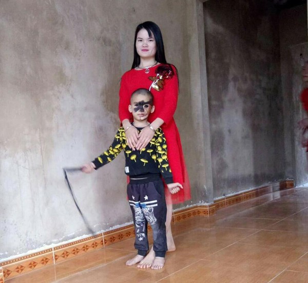 Cái Tết trọn vẹn đầu tiên của cậu bé 6 tuổi có khuôn mặt tựa người rừng tại Yên Bái - Ảnh 1.
