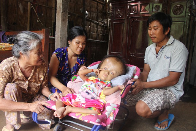 Phép màu kỳ diệu đến với cặp vợ chồng trẻ nuôi con gái 4 tuổi bị não úng thủy, đầu to gấp 3 lần trong năm mới - Ảnh 12.