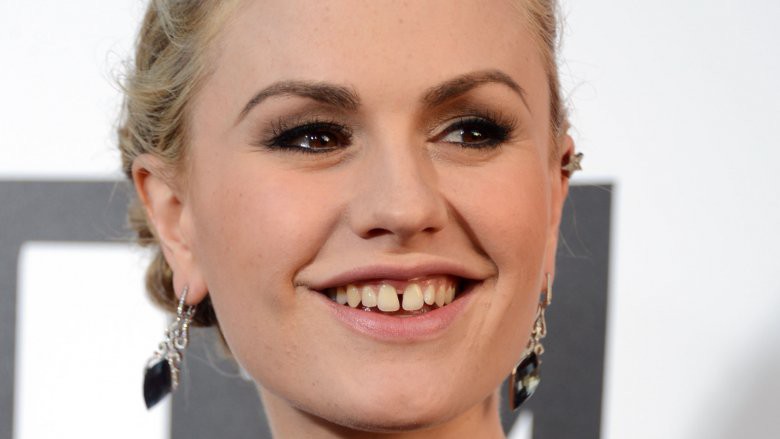 Vừa ố vàng vừa mọc lệch, đây là các sao có hàm răng xấu nhất Hollywood - Ảnh 4.