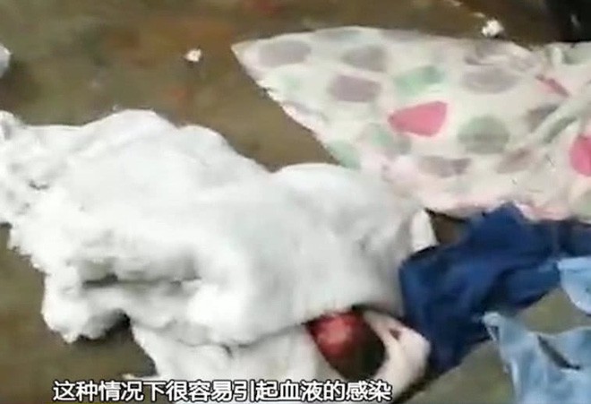 Giấu giếm việc mang bầu, thai phụ nửa đ&ecirc;m n&oacute;i ra ngo&agrave;i đi vệ sinh rồi l&acirc;m bồn ngay b&ecirc;n b&atilde;i r&aacute;c - Ảnh 1.