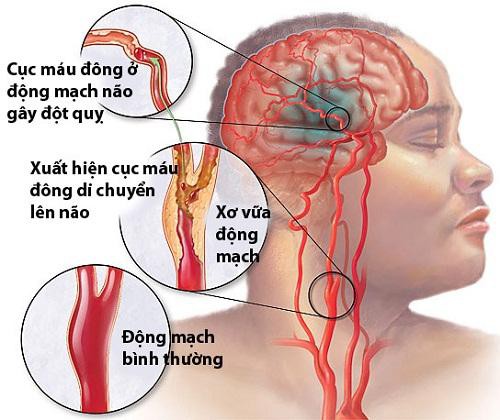 Tin được không, miếng dán như Salonpas này có thể cứu được mạng người - Ảnh 1.