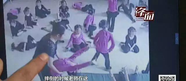 Bị ng&atilde; khi tập động t&aacute;c uốn dẻo trong lớp m&uacute;a, b&eacute; g&aacute;i 4 tuổi bại liệt do tổn thương tủy sống - Ảnh 2.