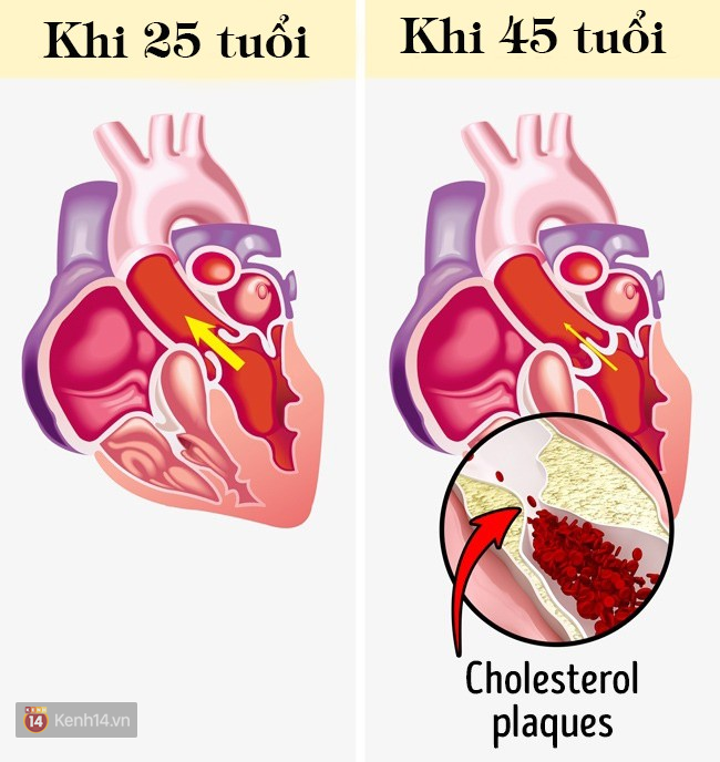 Bạn sẽ đối mặt với những hậu quả khủng khiếp này nếu cứ ngồi im một chỗ 8 tiếng/ngày - Ảnh 3.