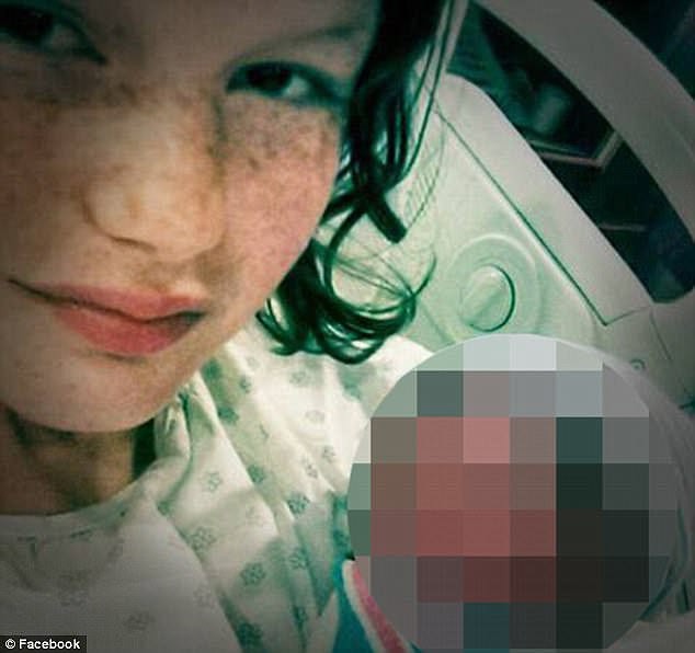 Bố mẹ nghiện ngập bỏ rơi, cô bé 15 ngày tuổi bị chuột cắn tới 100 nhát, tổn thương nặng ở vùng mặt - Ảnh 2.
