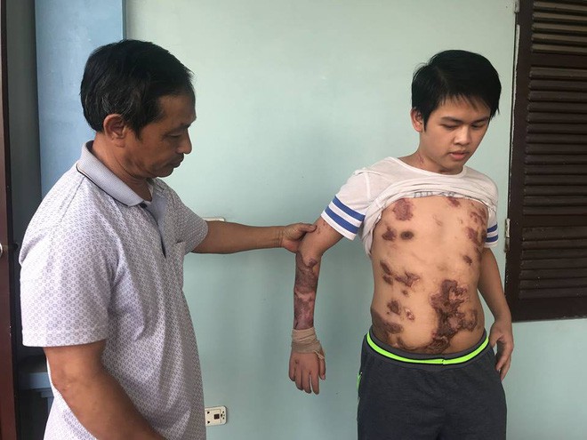  Cậu bé 16 tuổi sống sót sau vụ cháy xưởng bánh kẹo khiến 8 người tử vong ở Hà Nội bây giờ ra sao  - Ảnh 1.