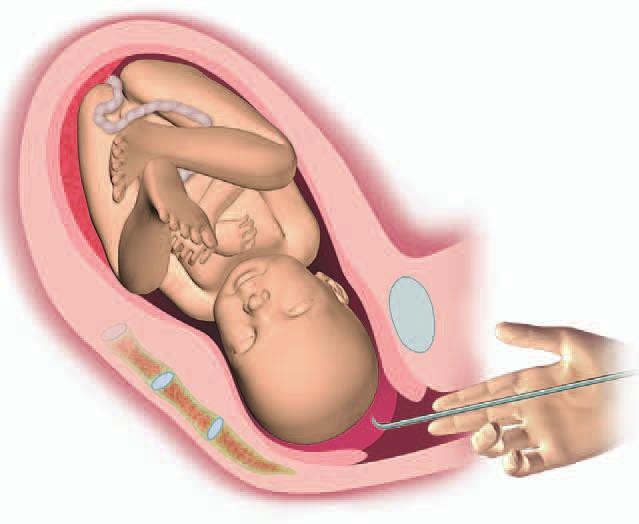 Bé gái chào đời với đỉnh đầu bị cào rách, gia đình tức giận yêu cầu lời xin lỗi từ phía bệnh viện - Ảnh 1.