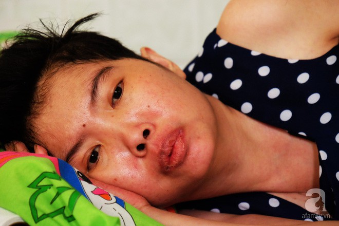 V&igrave; t&igrave;nh y&ecirc;u, người đ&agrave;n &ocirc;ng tự tay chăm s&oacute;c vợ hờ mang bệnh hiểm ngh&egrave;o chảy m&aacute;u v&ugrave;ng k&iacute;n, thương con vợ như con m&igrave;nh - Ảnh 13.