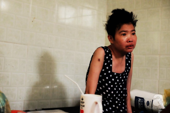 V&igrave; t&igrave;nh y&ecirc;u, người đ&agrave;n &ocirc;ng tự tay chăm s&oacute;c vợ hờ mang bệnh hiểm ngh&egrave;o chảy m&aacute;u v&ugrave;ng k&iacute;n, thương con vợ như con m&igrave;nh - Ảnh 7.