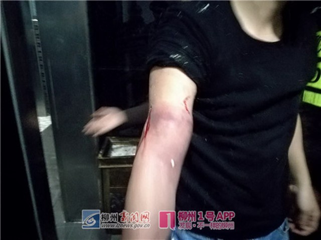 Chàng trai Trung Quốc suýt mất tay vì cố nhặt iPhone 8 rơi xuống xí xổm - Ảnh 2.