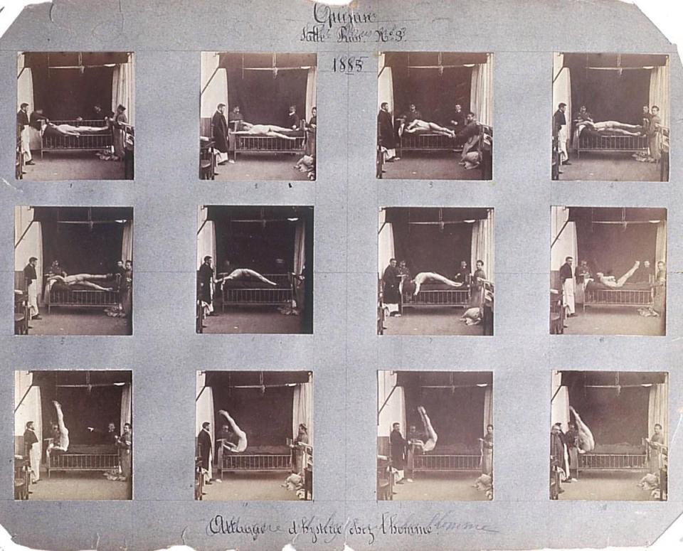 Những hình ảnh rùng rợn tại một trại thương điên thế kỷ 19 ở Pháp, nơi mà phần lớn bệnh nhân bị chữa trị... nhầm bệnh Photo-1-1521300592089542767620