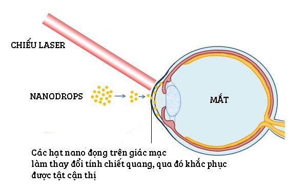 Thực hư thông tin thuốc nhỏ mắt của Israel chữa được cận thị - Ảnh 3.