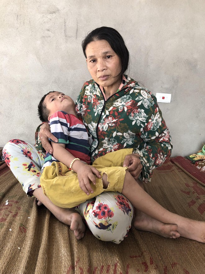 Số phận nghiệt ng&atilde; của đứa trẻ kh&ocirc;ng cha, mẹ bị động kinh bỏ nh&agrave; đi khi b&eacute; mới 6 th&aacute;ng tuổi - Ảnh 2.