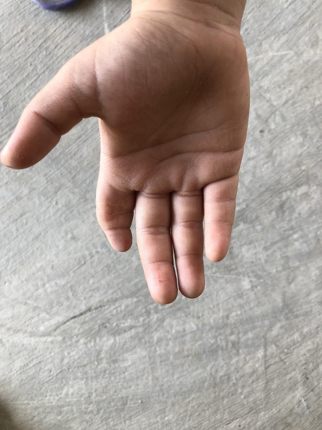Số phận nghiệt ng&atilde; của đứa trẻ kh&ocirc;ng cha, mẹ bị động kinh bỏ nh&agrave; đi khi b&eacute; mới 6 th&aacute;ng tuổi - Ảnh 3.