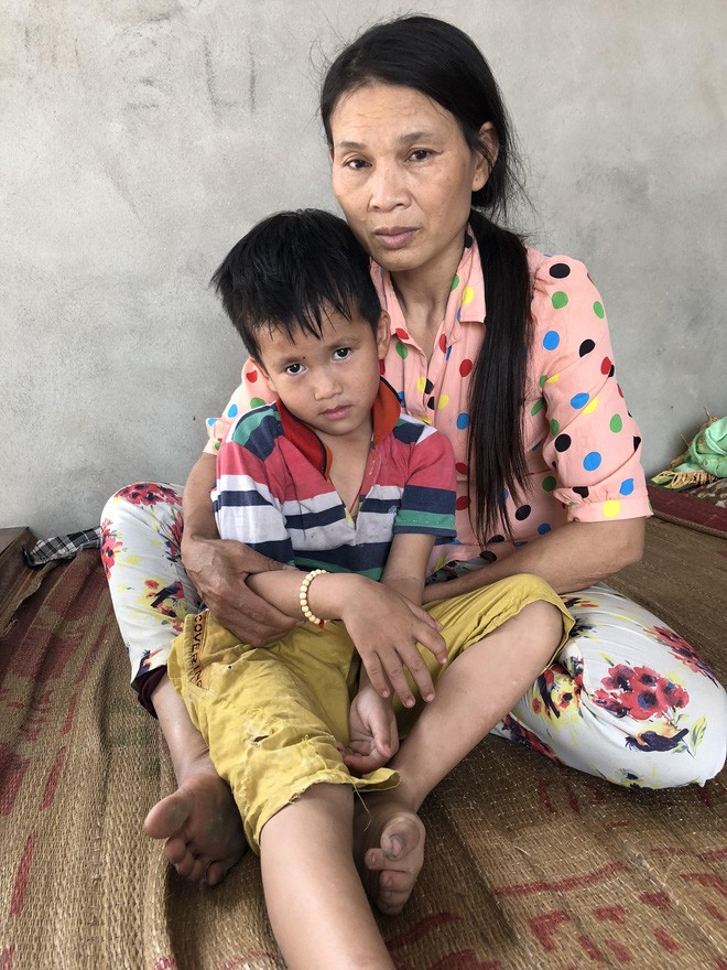 Số phận nghiệt ng&atilde; của đứa trẻ kh&ocirc;ng cha, mẹ bị động kinh bỏ nh&agrave; đi khi b&eacute; mới 6 th&aacute;ng tuổi - Ảnh 6.